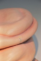 On the Mend (detail), 2022, ceramic, silicone, medical sutures. approx. 35”x24”x24”