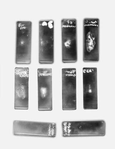 E.coli, 2022, archival inkjet print, 8.5 x 11 in