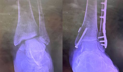 Untitled 25, 2026, archival inkjet print, 20 x 12 in.