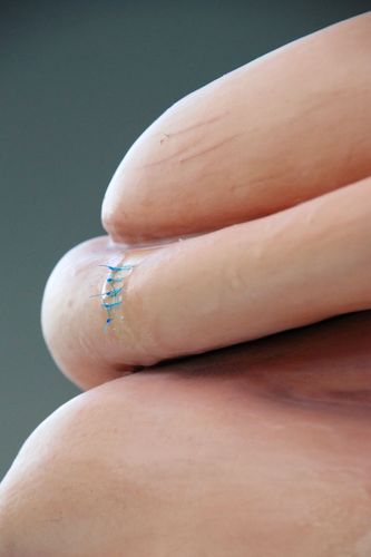 On the Mend (detail), 2022, ceramic, silicone, medical sutures. approx. 35”x24”x24”